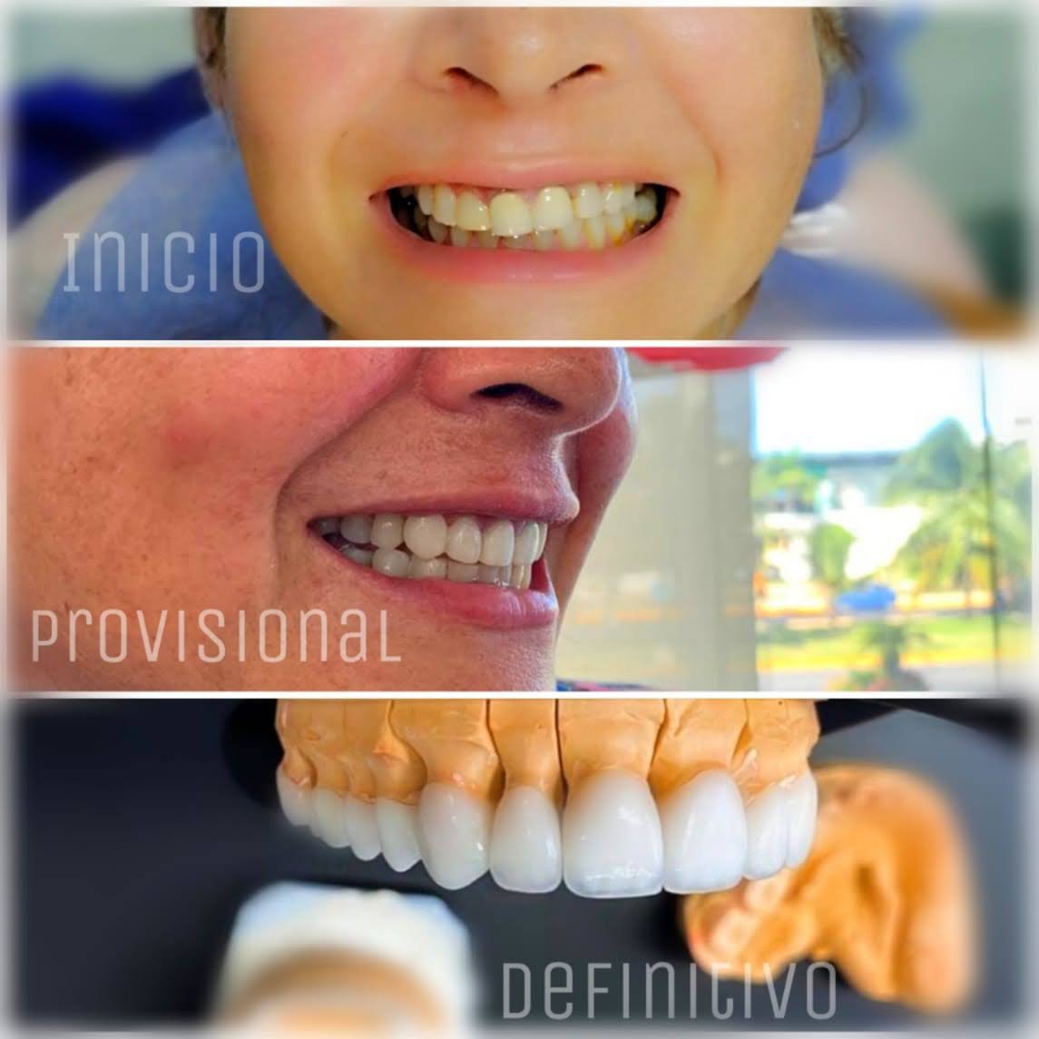 Transformación completa: de inicio a sonrisa definitiva