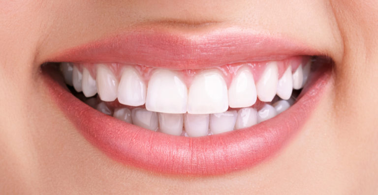 Diseño de Sonrisa Estética